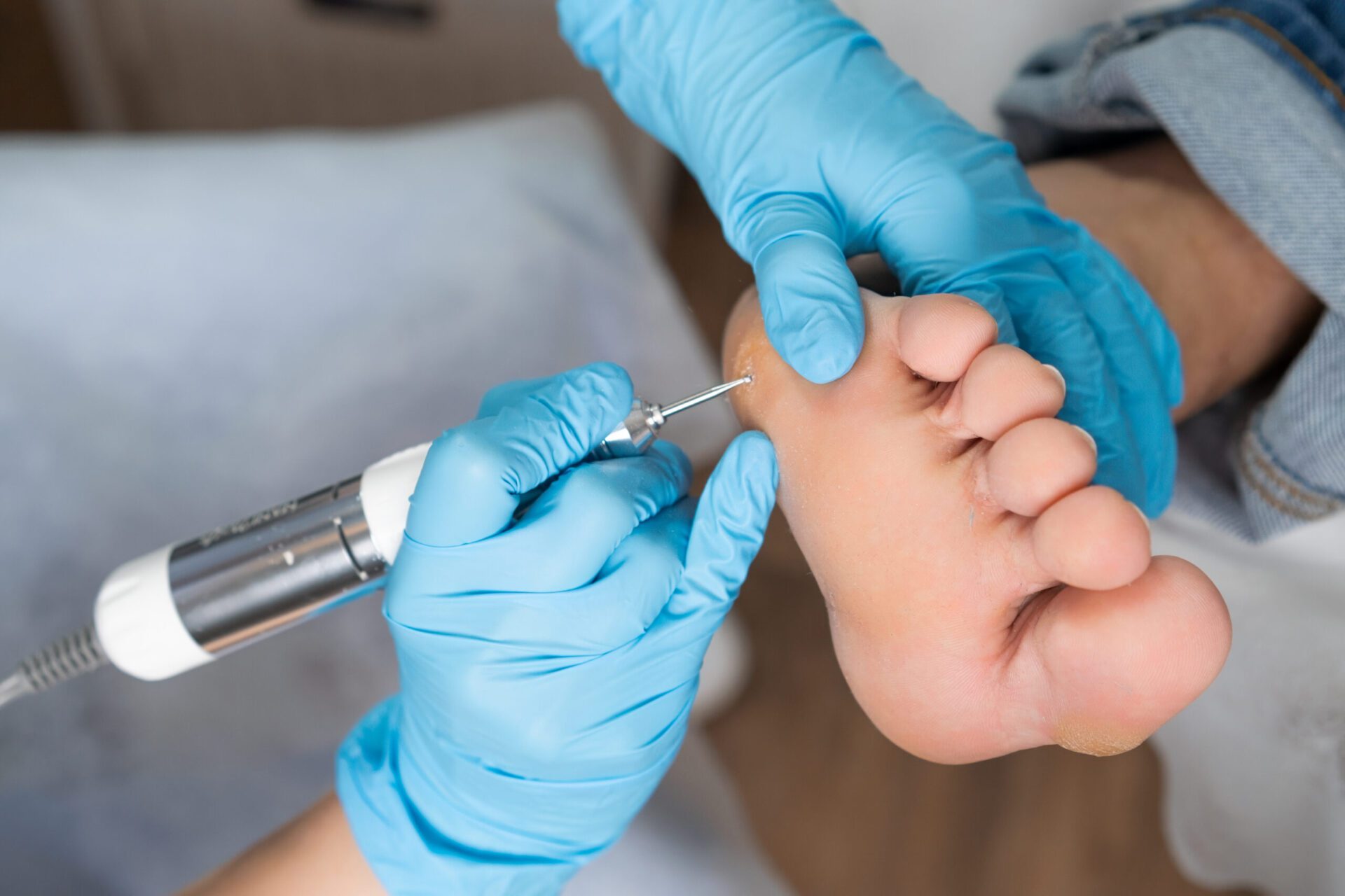 Professional removing a callus on a womans foot by electric drill Happy female doctor at office with patient
